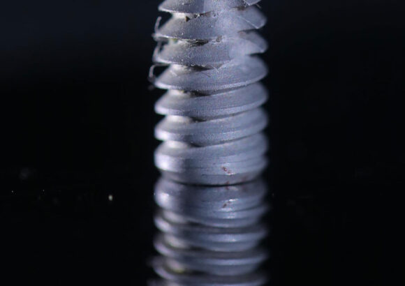 Dental Implants