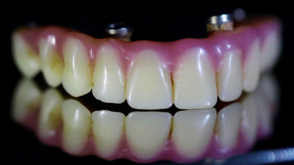Dentures