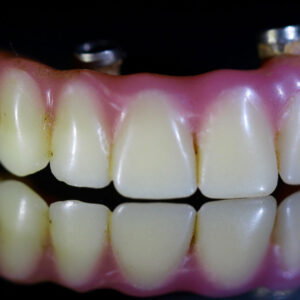 Dentures