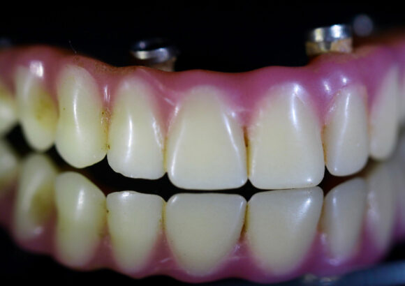 Dentures